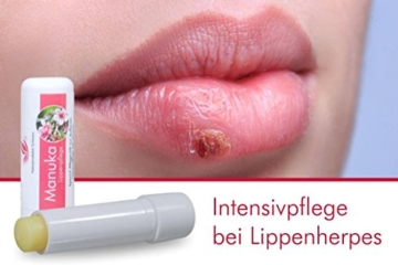 Naturprodukte Schwarz - Manuka Lippenpflege - Lippenstift bei Herpes, 4,8g - 4